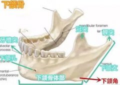 差了几毫米的下颌角手术术后果会有什么样的变化？ width=