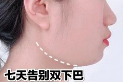 五个瘦脸动作 | 七天告别双下巴！淡化法令纹！消除婴儿肥！ width=