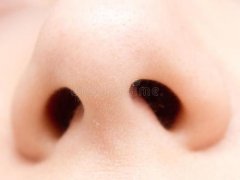 鼻翼缩小手术没问题吗?选对医院和医生是关键 width=