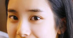 双眼皮需要拆线吗​？ width=