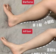 简单4步 | 懒人按摩瘦腿—消除肥大小腿肚、肌肉腿！！ width=