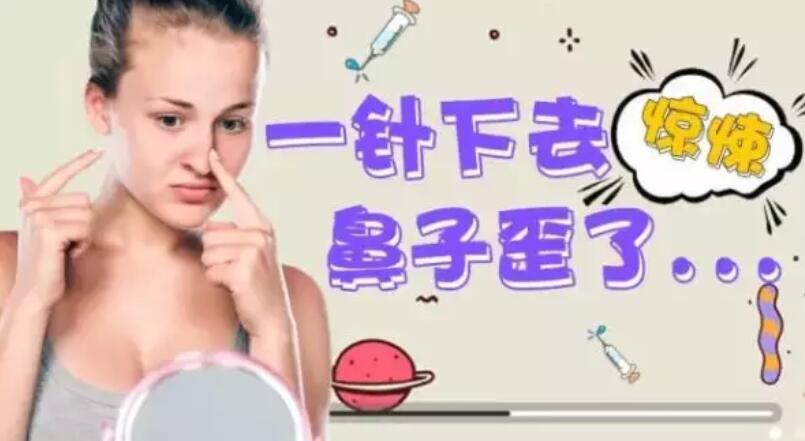 【隆鼻术失败修复怎么办？看这个小姐姐是怎么处理的！】