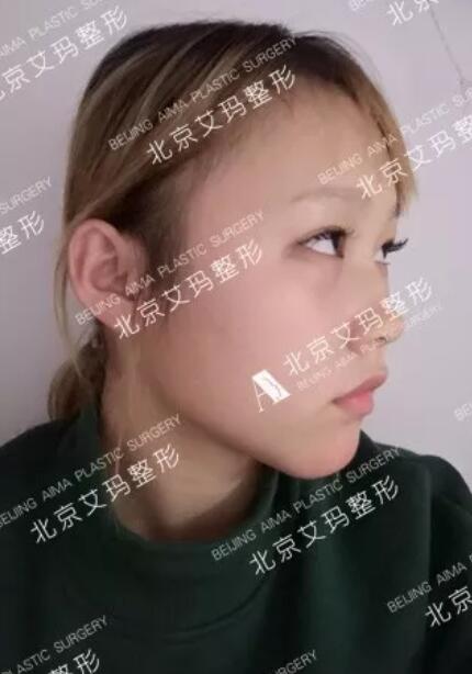 【真实案例】因为爱臭美，大学生被注射了……