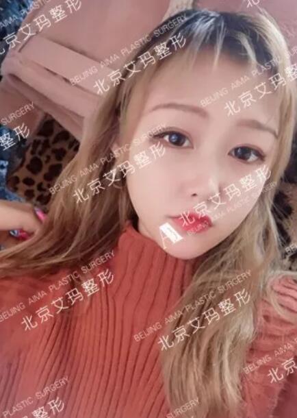 【真实案例】因为爱臭美，大学生被注射了……