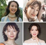 换头手术需要哪些步骤|这是较近网友问题比较多的问题！ width=