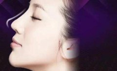 隆鼻整形后可以戴眼镜吗?隆鼻术后什么时候可以锻炼? width=
