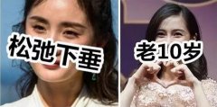 割过双眼皮，过了30岁肯定下垂？ width=