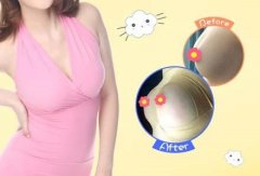做康宁玛格丽特假体隆胸具有哪些特点?备受每个女士信任。 width=
