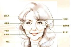 除皱手术让你拥有不老容颜就是这么简单 width=