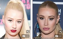 Iggy Azalea通过垫下巴和下颌角整形改变了她的脸，格外引人注目！ width=