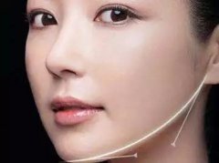 磨骨手术+棱角下巴矫正变成可爱的小仙女 width=