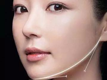 磨骨手术+棱角下巴矫正变成可爱的小仙女