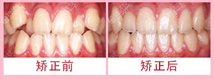 【上海尤旦口腔正规靠谱吗？牙齿矫正案例价格表及医院资质来揭晓！】