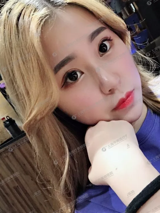 做双眼皮前不搞清楚这个问题，小心被坑惨~