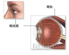 提肌恢复期出现不对称怎么办? width=