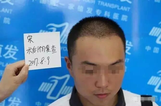 【博士园植发靠谱吗？博士园医院植发案例有吗？】