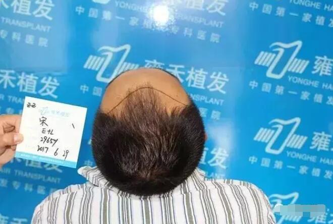 【博士园植发靠谱吗？博士园医院植发案例有吗？】
