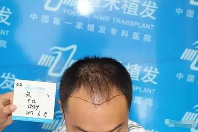 【博士园植发靠谱吗？博士园医院植发案例有吗？】
