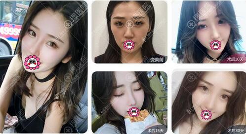 【广州华美整形怎么样？三月特惠活动来袭！】