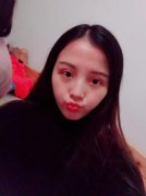 沈阳杏林整容医院【价目表】大全一览【辣妹全切双眼皮案例分享】 width=