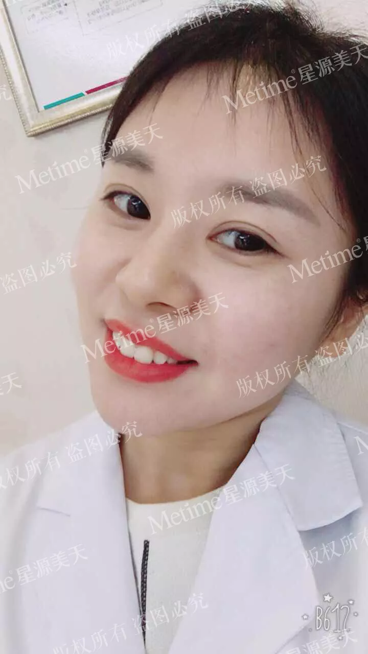 开眼角前后对比图片