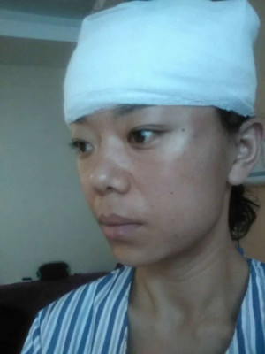 衡阳雅韩医疗的张文友医生的面部提肌怎么样?