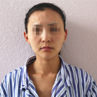 美白果对比现在该知道这Name不是白叫的吧