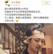 FUT植发猛料——脱发患者的救星 width=