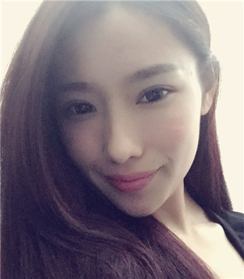 打注射瘦脸前后果图