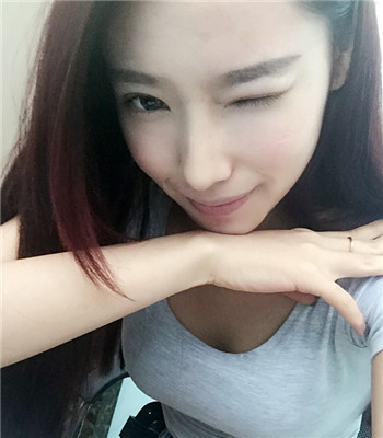 打注射瘦脸前后果图