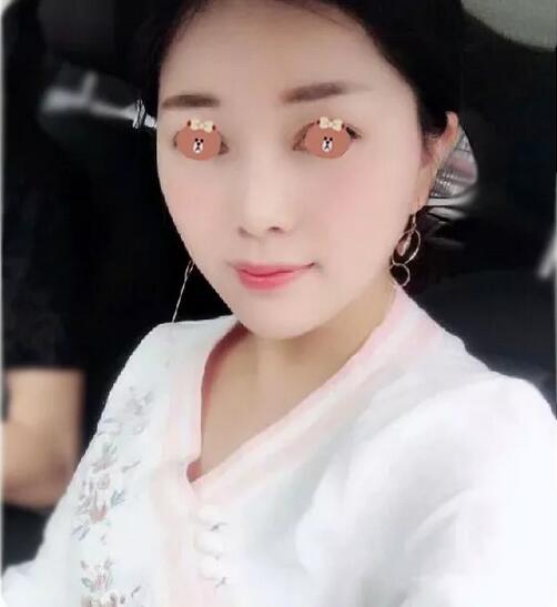 【济南伊美尔嫩肤抗老+提拉紧致经历，我佩服得五体投地！】