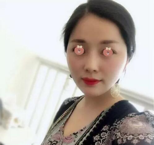 【济南伊美尔嫩肤抗老+提拉紧致经历，我佩服得五体投地！】