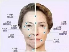 光波拉皮的技术原理与术后的保养事项 width=