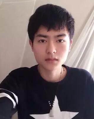 男士下颌角整形对比图，谁说整形是女人的专利