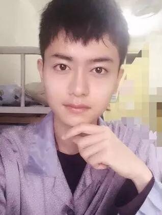 男士下颌角整形对比图，谁说整形是女人的专利
