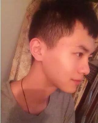 男士下颌角整形对比图，谁说整形是女人的专利