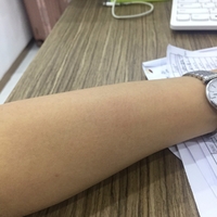半导体激光脱毛好吗?我相信这次脱毛肯定是一次愉快的经历