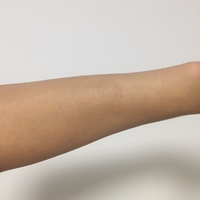 半导体激光脱毛好吗?我相信这次脱毛肯定是一次愉快的经历