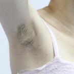 北京激光脱毛多少钱?让我这个北京爱美者来告诉你
