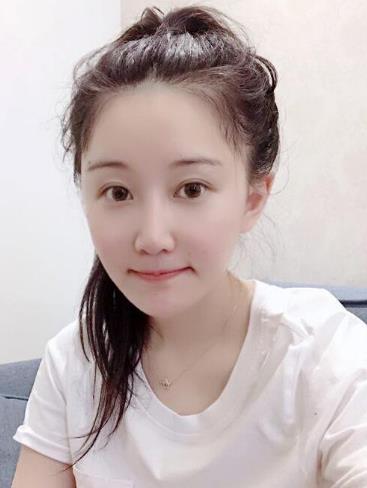 于霞吸脂案例