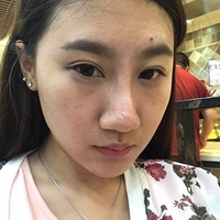 热玛吉紧肤果怎么样?我们用实际情况来说话