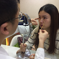 成都仪美整形两月前做的双眼皮还在恢复中，先看看恢复果吧