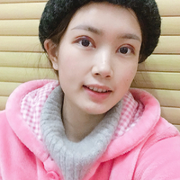 成都仪美整形两月前做的双眼皮还在恢复中，先看看恢复果吧