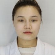 成都美芯东裕做的双眼皮，果自然来~ width=