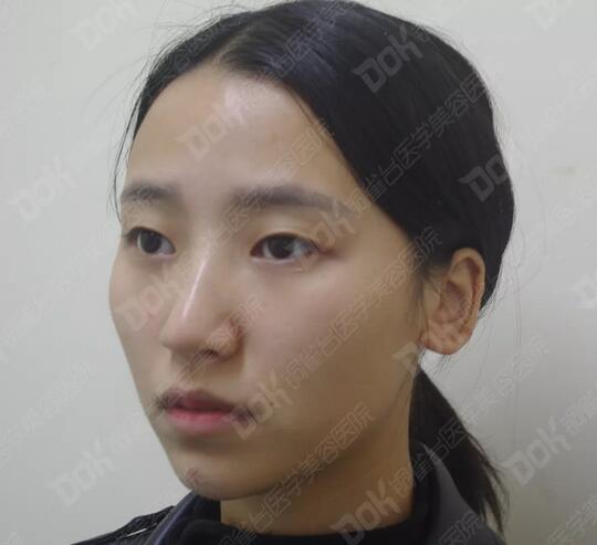 韩式翘睫双眼皮