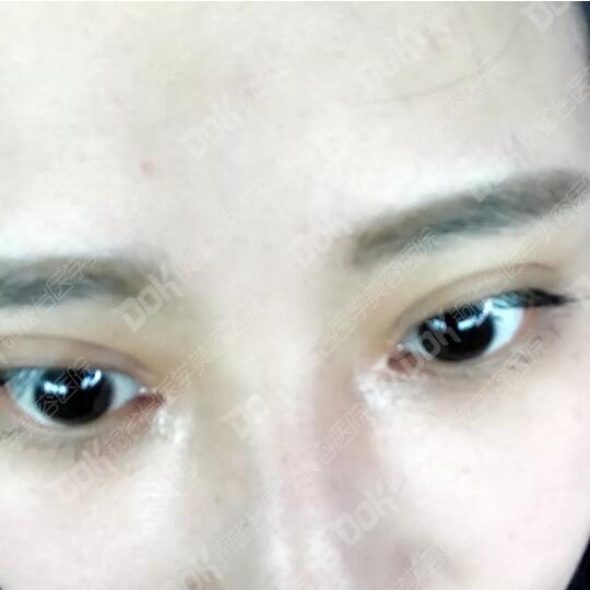 韩式翘睫双眼皮