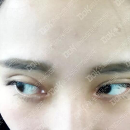 韩式翘睫双眼皮