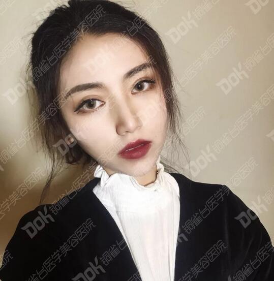 韩式翘睫双眼皮