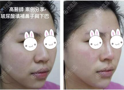 广州名韩整形周末迎来多位大咖，优惠价格表真诚奉上！