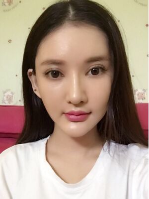 筋膜悬吊除皱术 让你青春永驻
